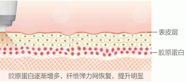 沈阳热玛吉授权医院是哪几家