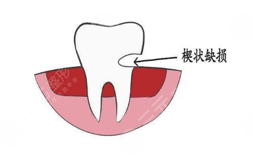 北京大学深圳医院牙齿修复科哪个医生好