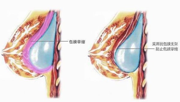 南方醫(yī)科大學(xué)南方醫(yī)院整形外科怎么樣