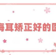 上海耳矯正好的醫(yī)院有哪些