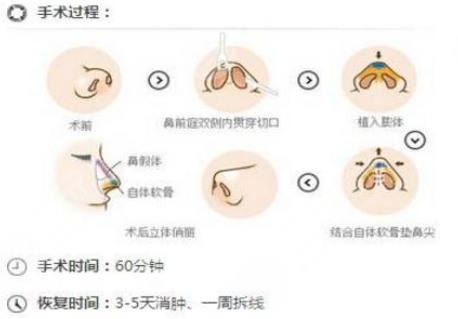 友誼整形外科醫(yī)院是公立嗎