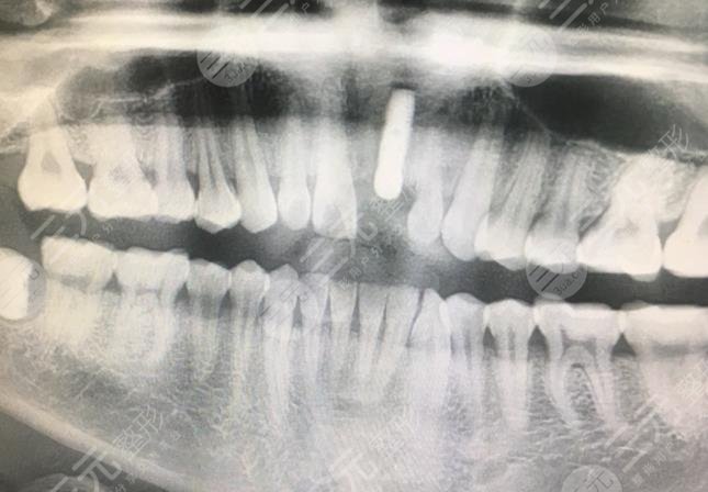 洛阳拜博口腔怎么样