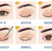 武漢美天整形價(jià)格表