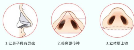 北京沃尔做鼻子技术怎么样
