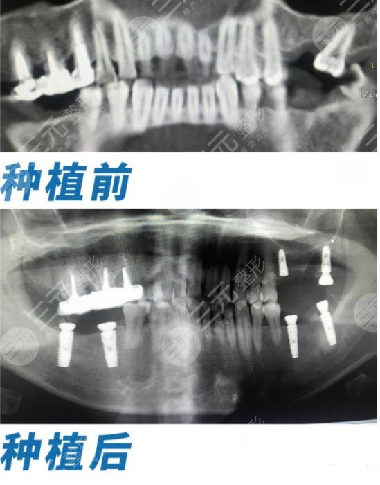 正夫口腔是正規(guī)的嗎