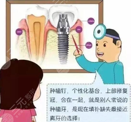 上海哪里种植牙齿好