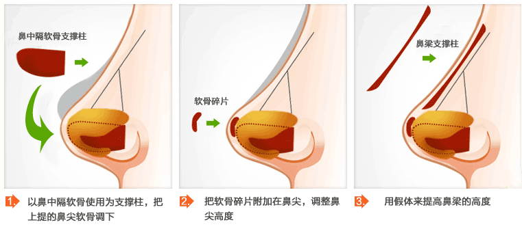 成都美極整形醫(yī)院價(jià)格表一覽曝光