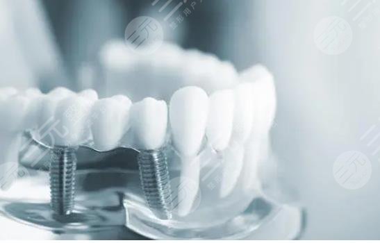 北京十大种植牙私立牙科排名榜单权威发布