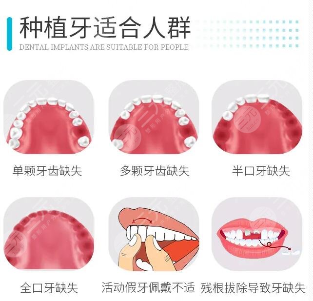 2022北京种植牙私立医院排名