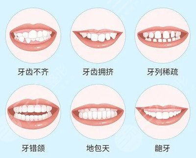 上海九院牙齿矫正价格表2020版新鲜发布
