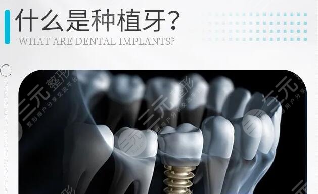 2022北京种植牙私立医院排名