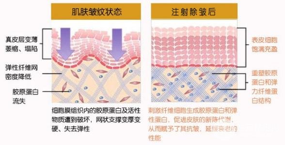 湘雅附一祛斑費用明細表 激光美容項目大全