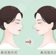 廈門欣醫(yī)美整形醫(yī)院價格大全一覽表
