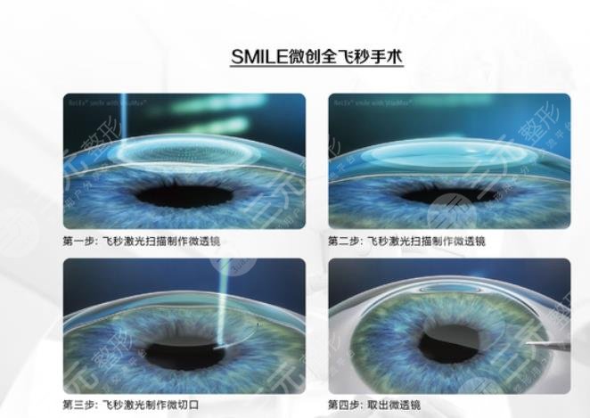 深圳眼科(近视矫正手术)医院排名+价格一览2022