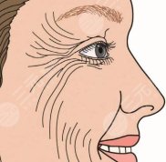 滄州中心醫(yī)院美容科去除抬頭紋成好嗎