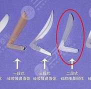 北京沃爾整形醫(yī)院鼻整形完整價(jià)目表搶先看
