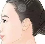 南寧華美整形美容醫(yī)院價格價目表全新一覽