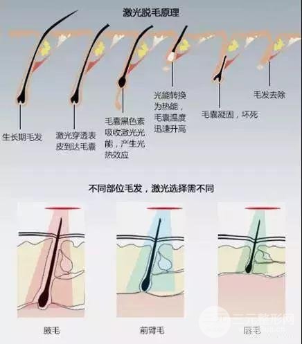 上海九院脫毛掛什么科