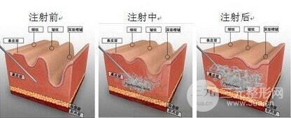 浙醫(yī)二院美容科價目表