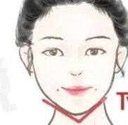 濟南旭美整形醫(yī)院是否是正規(guī)整形醫(yī)院