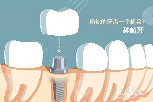 兰州种植牙哪家医院好