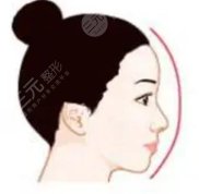 廣州市荔灣區(qū)人民醫(yī)院隆鼻怎么樣