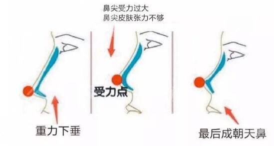 四川省人民医院隆鼻哪个医生好