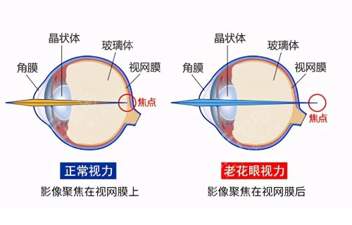 中山大学中山眼科中心近视眼激光治疗科医生