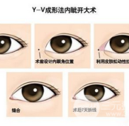 沈陽(yáng)軍區(qū)總醫(yī)院醫(yī)院整形科怎么樣價(jià)格表