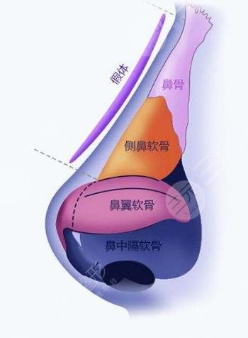 上海伊萊美做鼻部手術(shù)怎么樣