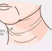 上海紐頓醫(yī)療美容怎么樣