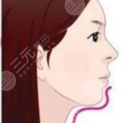 哈爾濱美聯(lián)致美整形醫(yī)院價(jià)格表一覽你懂的