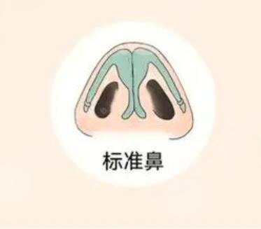 北京东方和谐做的鼻翼缩小整形手术真实案例分享