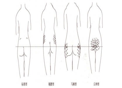 提臀瘦腿方法有5种这么多