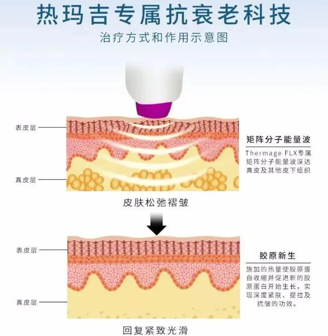 熱瑪吉和熱拉提哪個(gè)果好