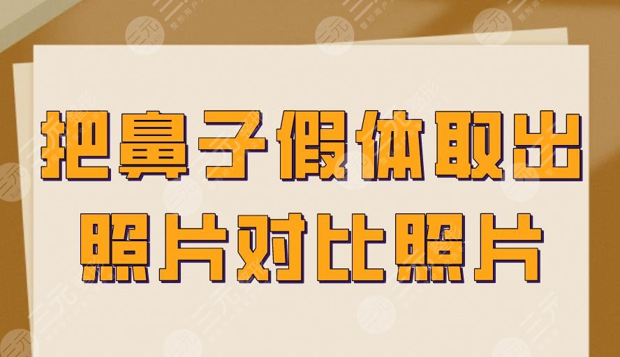 把鼻子假體取出照片對比照片