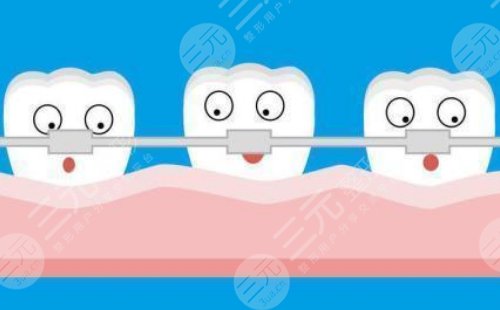 北京协和医院种植牙多少钱一颗