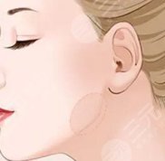 成都西區(qū)醫(yī)院整形價(jià)格表