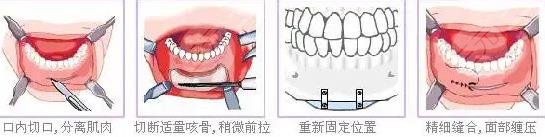 八大處陳瑩正頜預(yù)約掛號