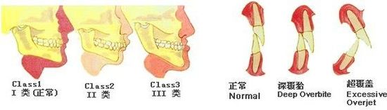 上海正颌手术费用一般多少钱