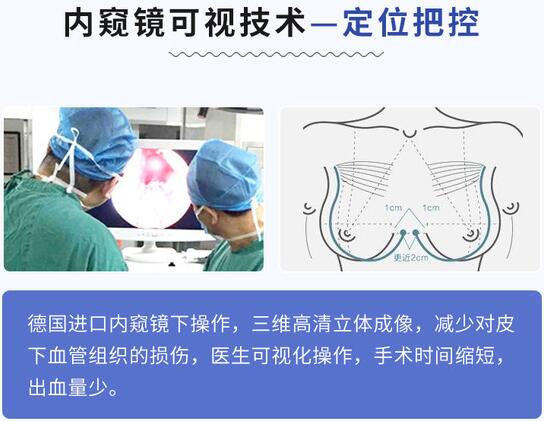 成都丰胸医院排名