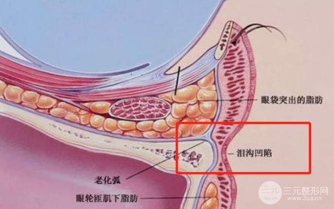 黄多多长大后泪沟黑眼圈全消