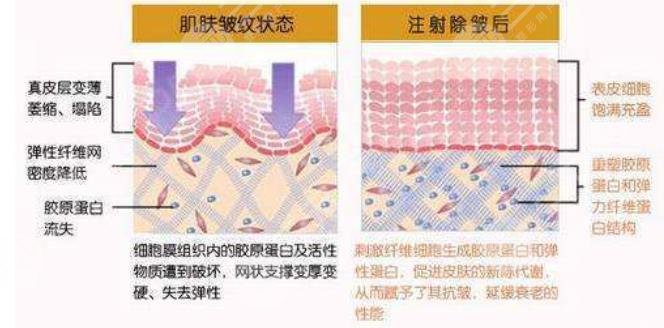 大慶注射除皺醫(yī)院排名