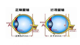 北京同仁医院眼科专家排名来袭