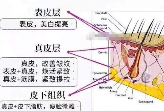 5gmax極速提拉價格是多少