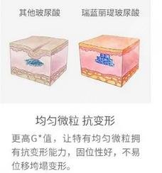 注射瑞蘭玻尿酸多少錢