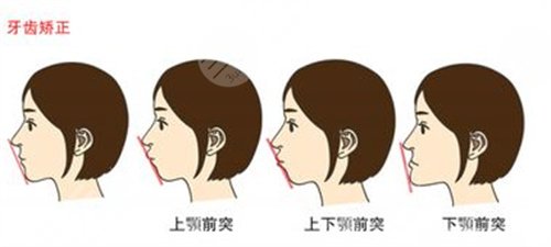 上海九院口腔外科专家哪个比较好