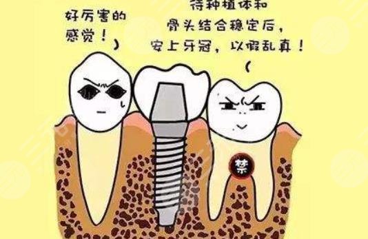 2022广州种植牙齿医院排行榜(排名)