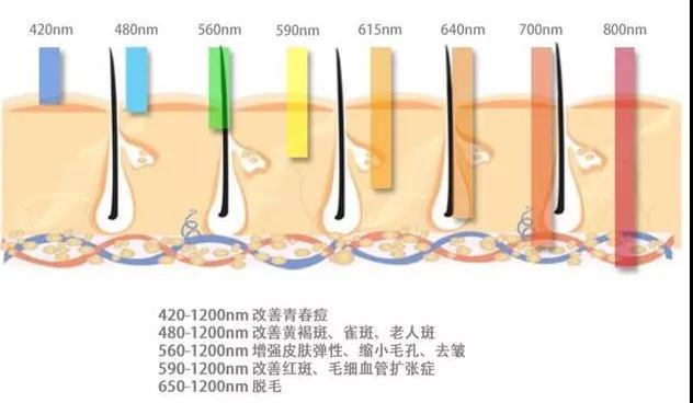 鄭州人民醫(yī)院光子嫩膚怎么樣