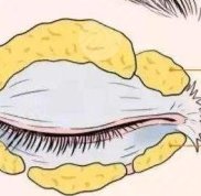 廣州軍美整形價格表
